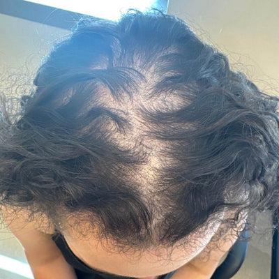 Hair gap